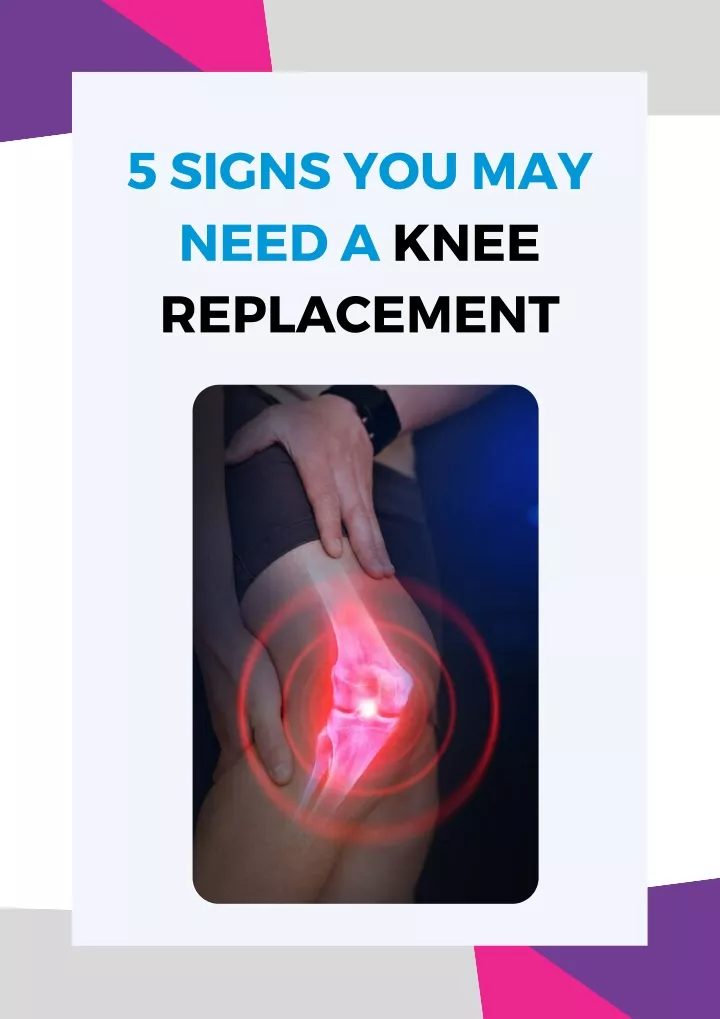5 signs you may need a knee replacement