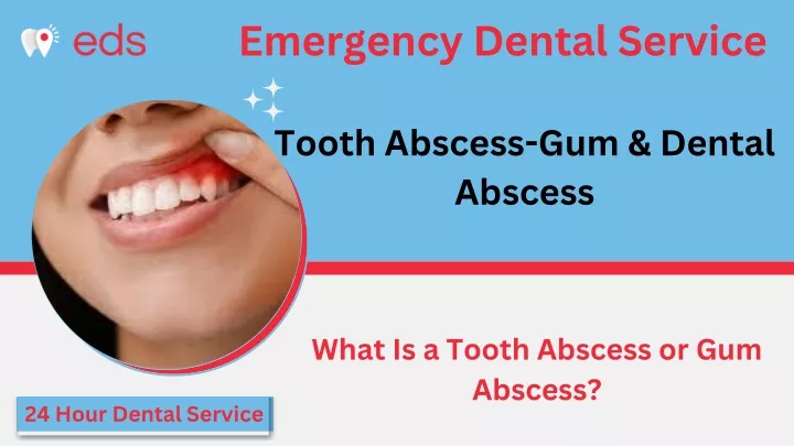 emergency dental service