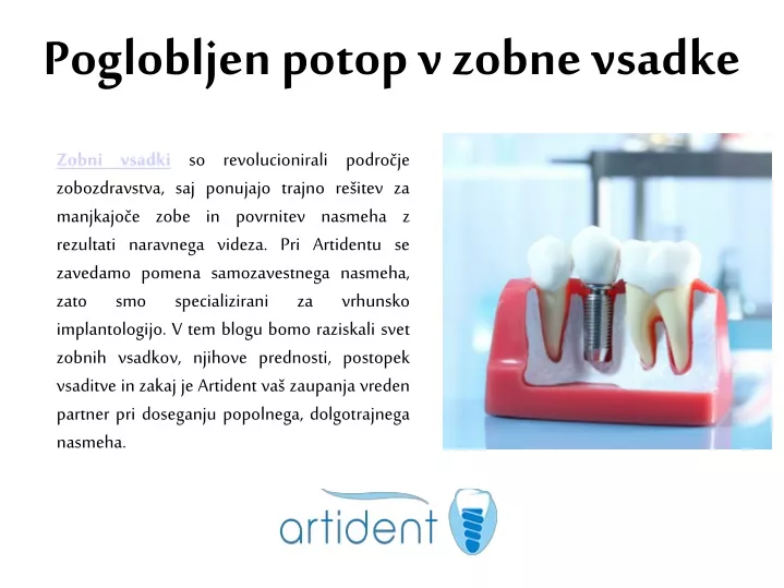 poglobljen potop v zobne vsadke