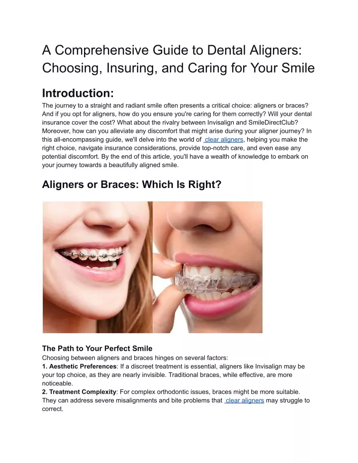 a comprehensive guide to dental aligners choosing