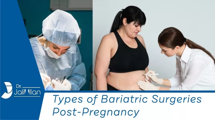 types of bariatric surgeries post pregnancy