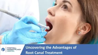 Discover the Benefits of Root Canal Treatment for Your Dental Health