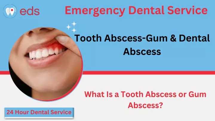 emergency dental service