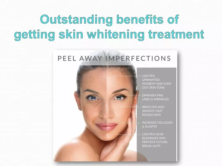 PPT Outstanding benefits of getting skin whitening treatment