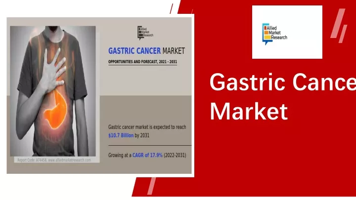 gastric cancer market