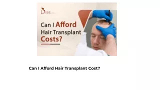 Can I Afford Hair Transplant Cost