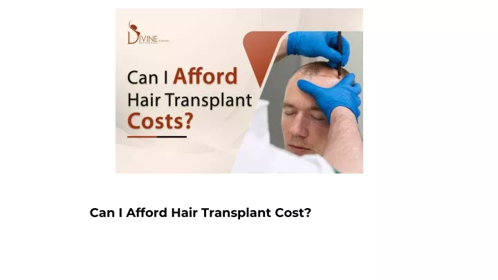 can i afford hair transplant cost