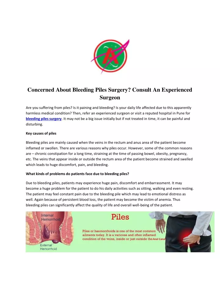 concerned about bleeding piles surgery consult