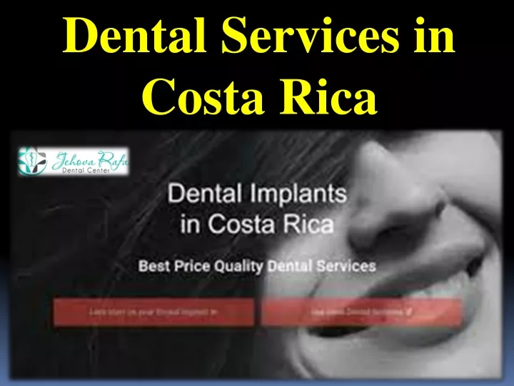 dental services in costa rica