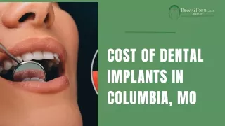 Cost of dental implants in Columbia, MO