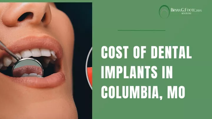 cost of dental implants in columbia mo
