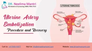 Uterine Artery Embolization: Procedure and Recovery | Dr Neelima Mantri