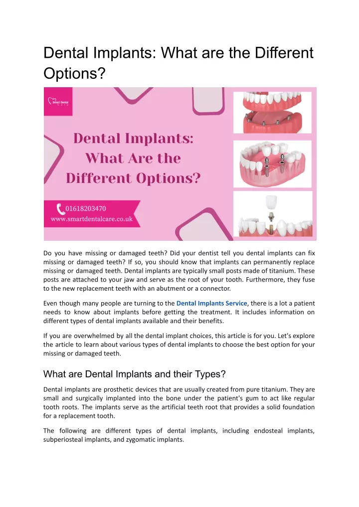 dental implants what are the different options