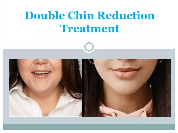 double chin reduction treatment