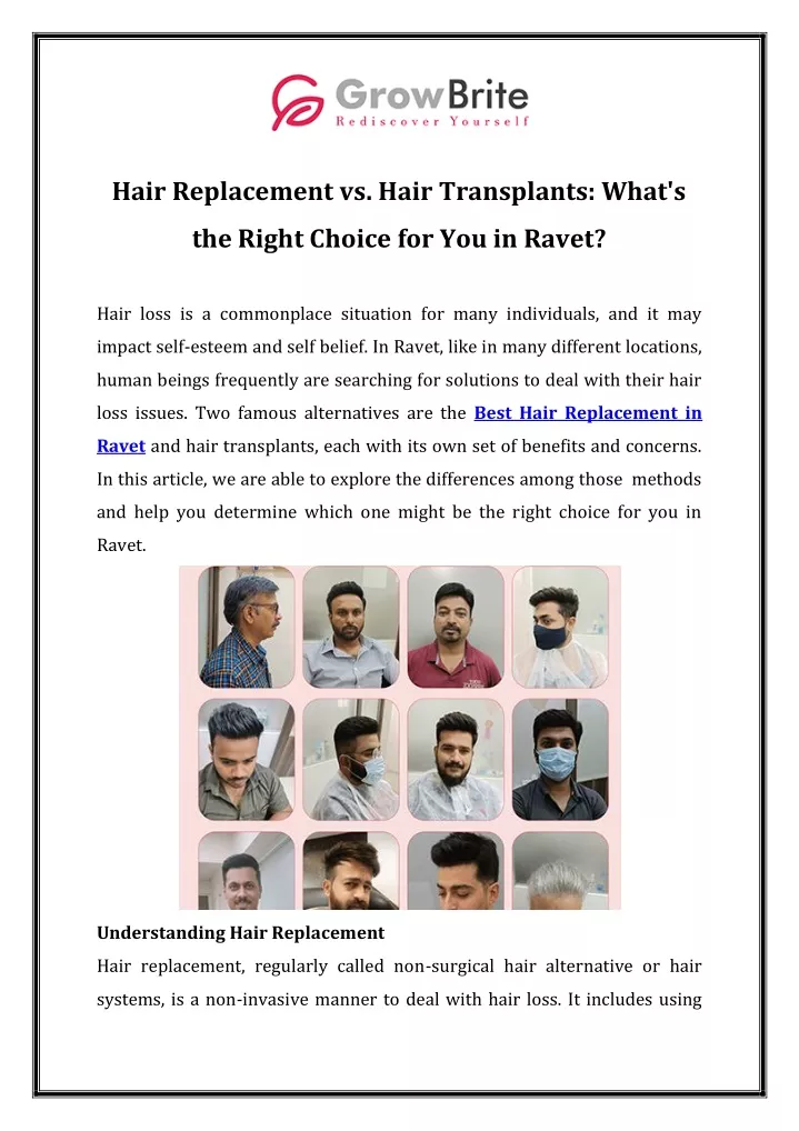 hair replacement vs hair transplants what s