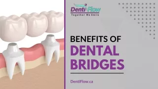 Enhancing Your Quality of Life with Benefits of Dental Bridges