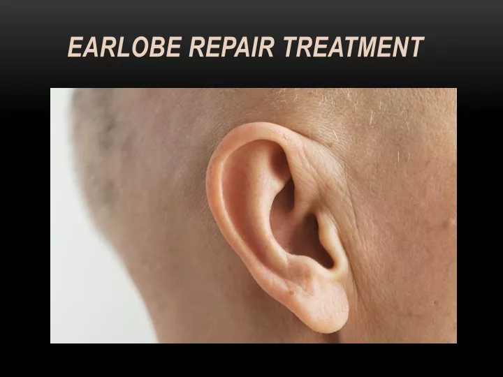earlobe repair treatment