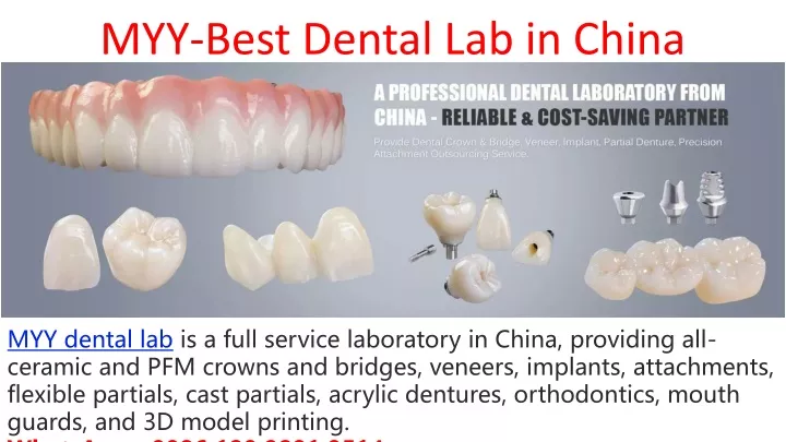 myy best dental lab in china
