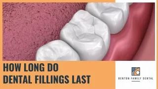 Understanding Dental Fillings: How Long Do They Last?