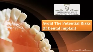 Avoid The Potential Risks Of Dental Implant