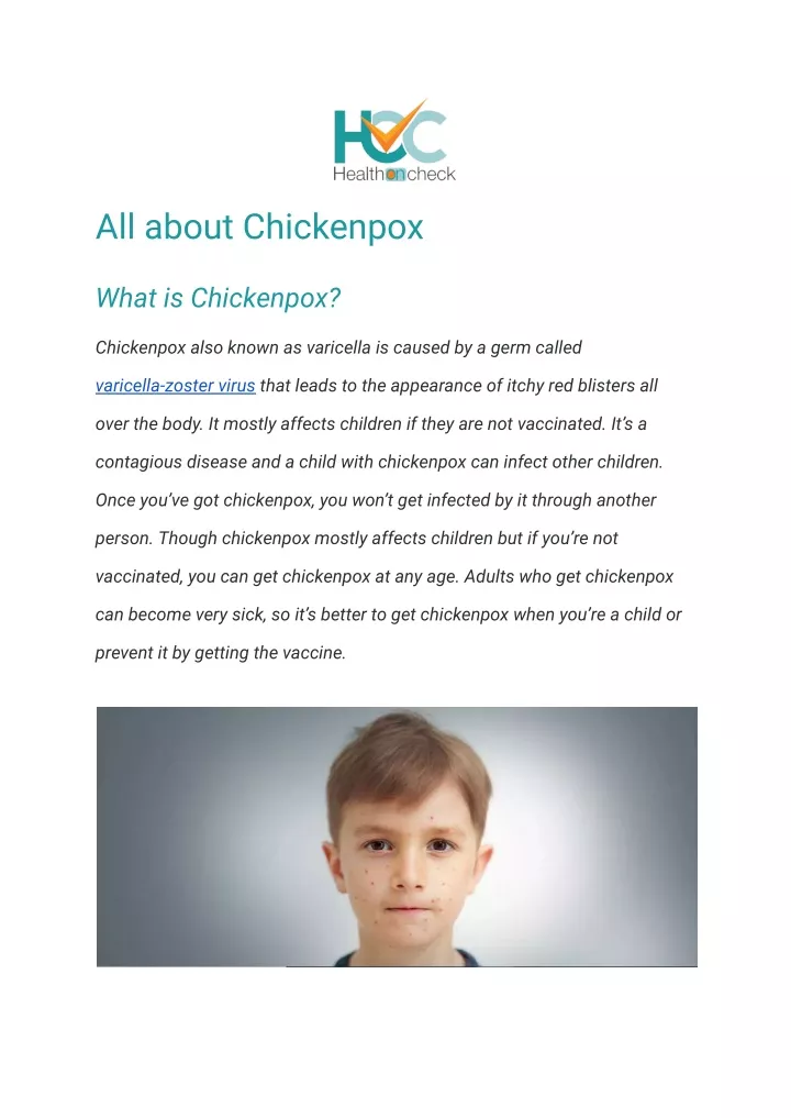 all about chickenpox