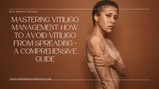 Mastering Vitiligo Management How to Avoid Vitiligo from Spreading A Comprehensive Guide
