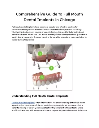 Comprehensive Guide to Full Mouth Dental Implants in Chicago