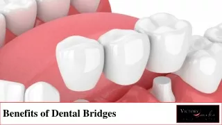 benefits of dental bridges