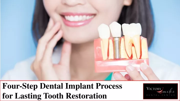 four step dental implant process for lasting