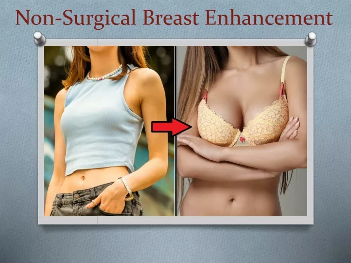 non surgical breast enhancement