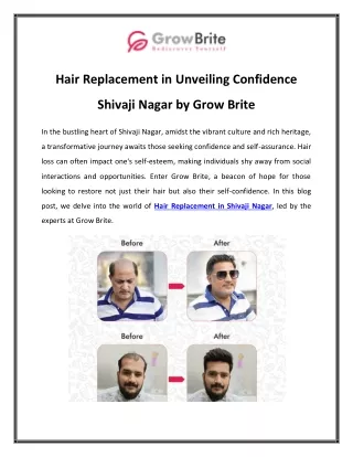 Hair Replacement in Unveiling Confidence Shivaji Nagar by Grow Brite