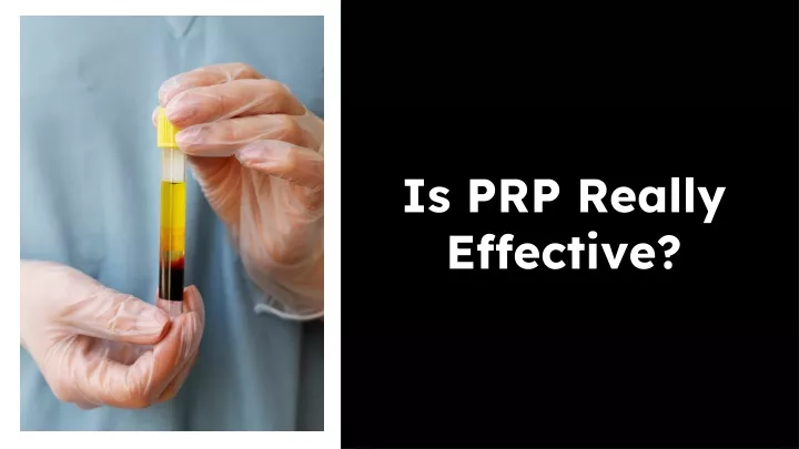 is prp really effective