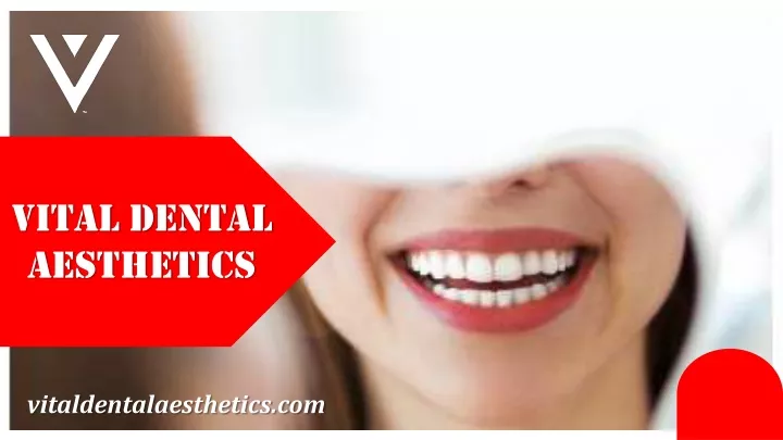 vital dental aesthetics