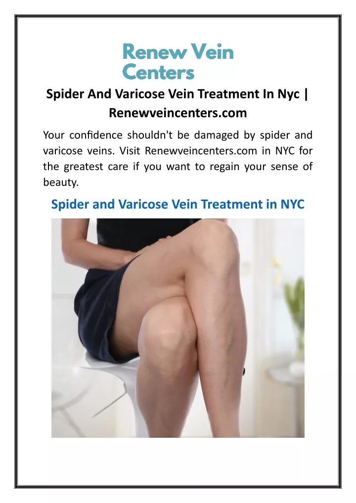 spider and varicose vein treatment