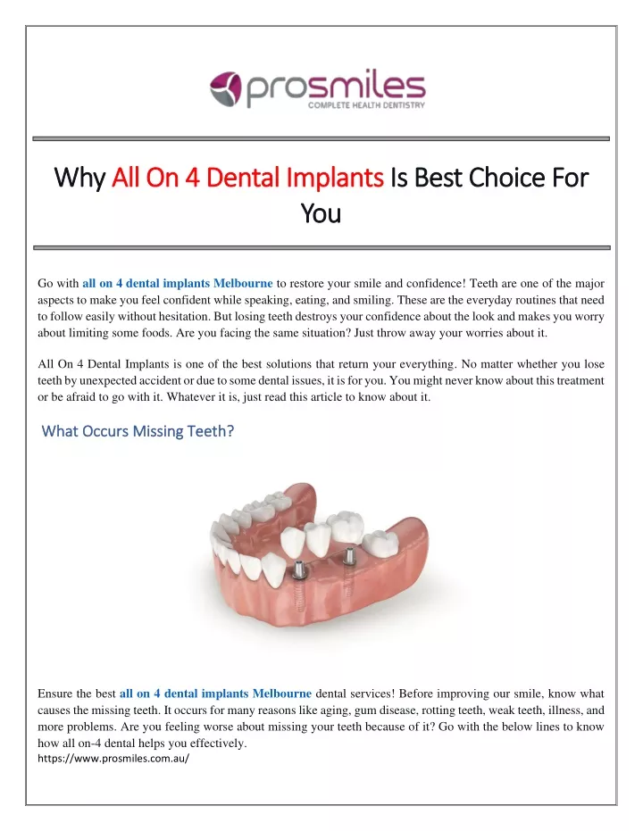 why why all on 4 dental implants all on 4 dental