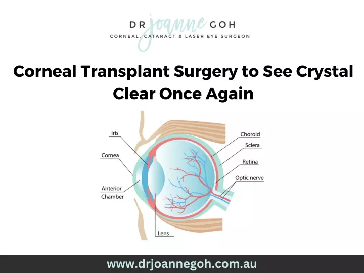 corneal transplant surgery to see crystal clear