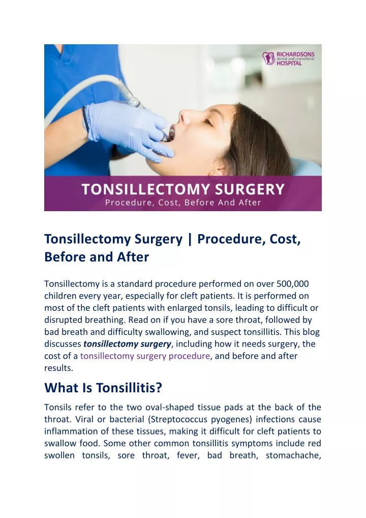 tonsillectomy surgery procedure cost before