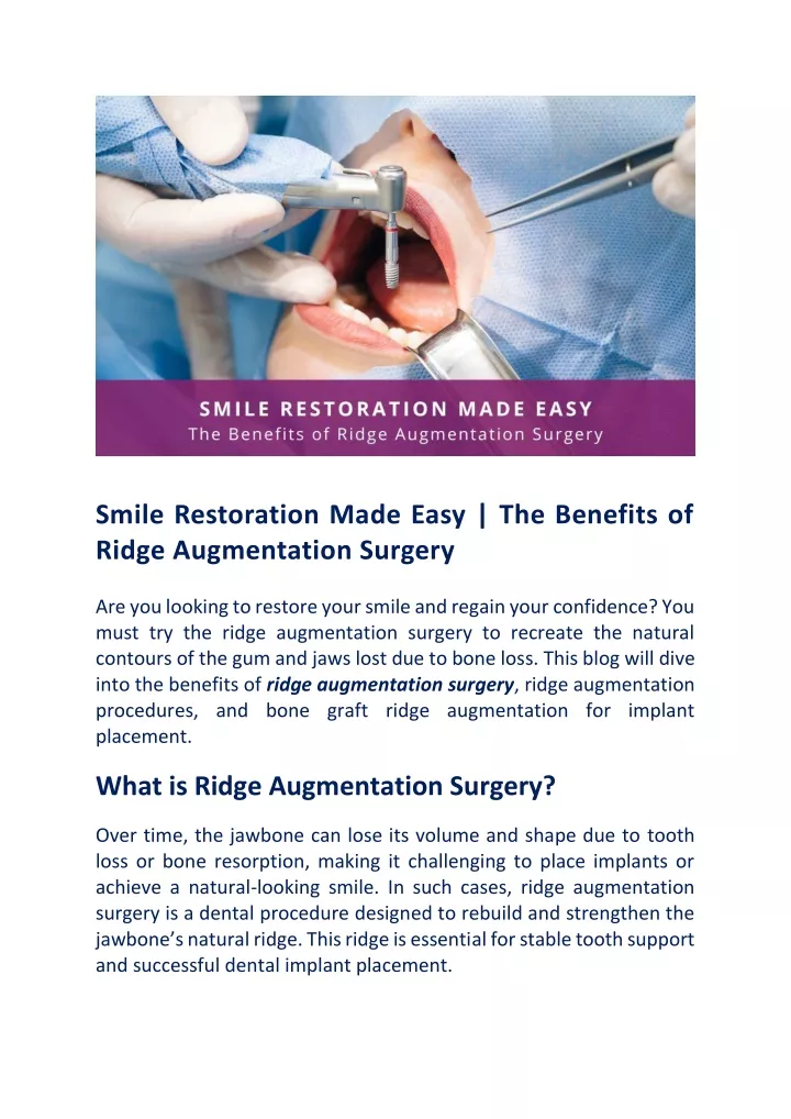 smile restoration made easy the benefits of ridge