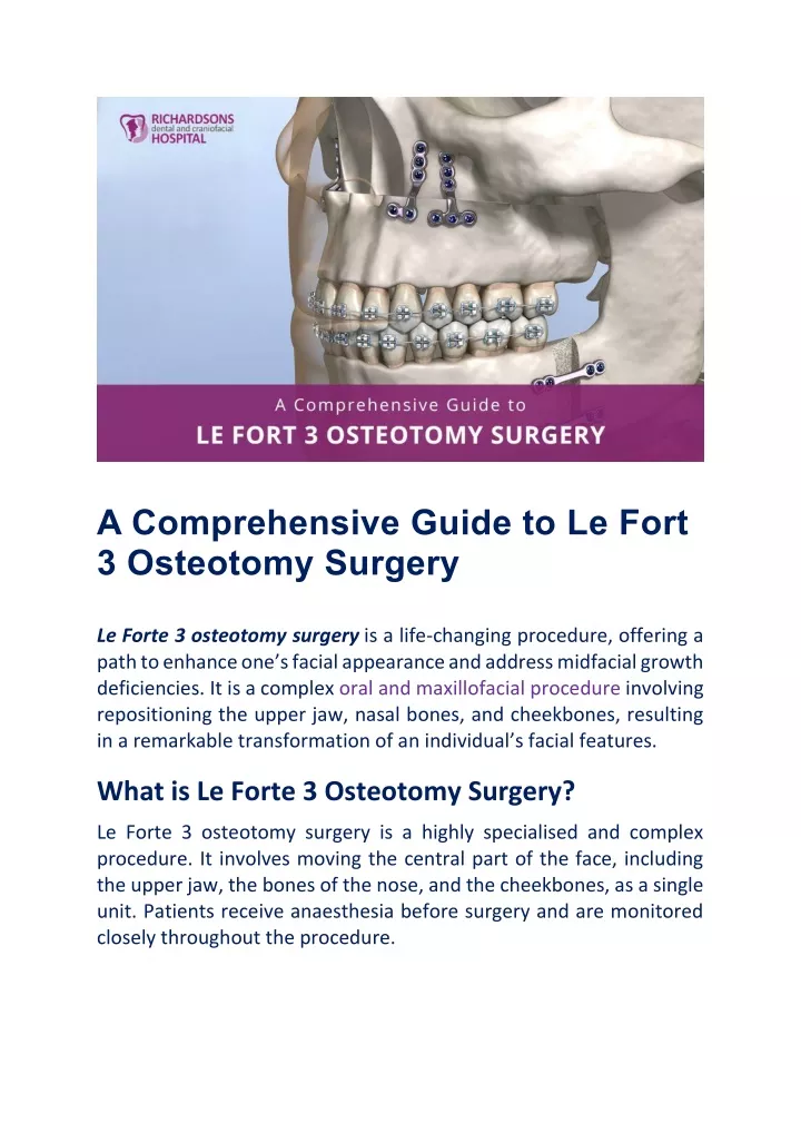 a comprehensive guide to le fort 3 osteotomy