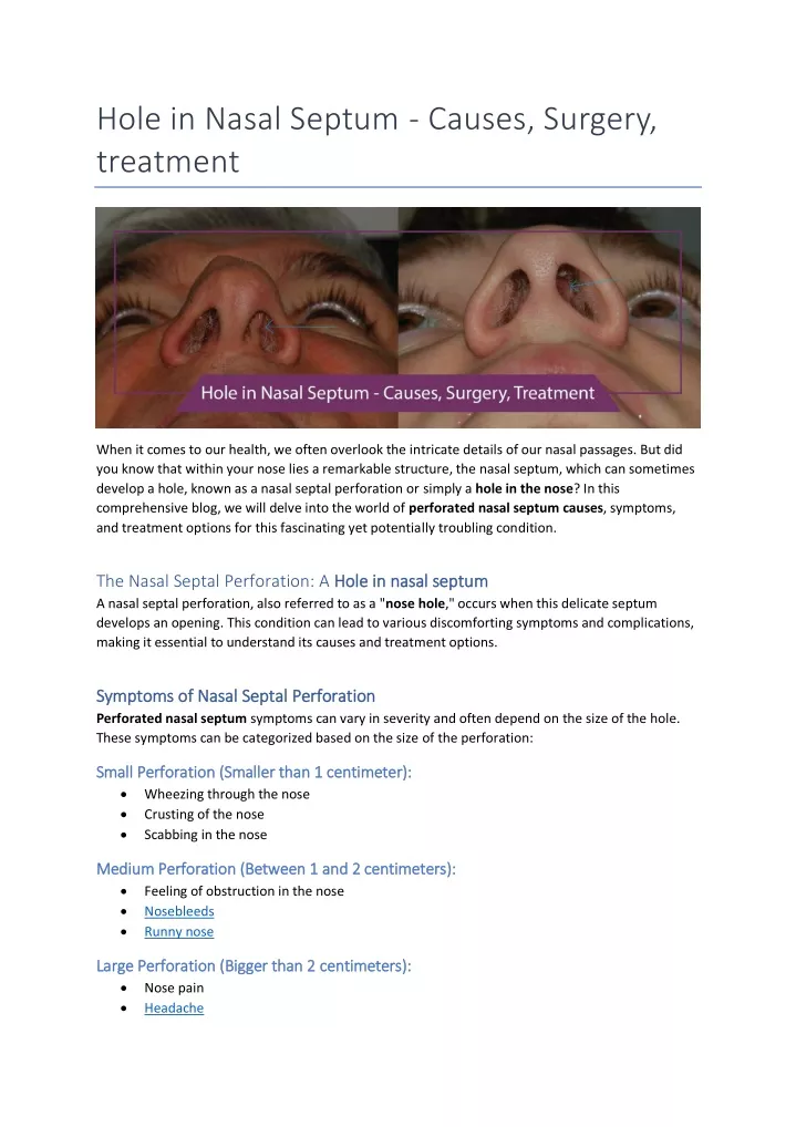 hole in nasal septum causes surgery treatment