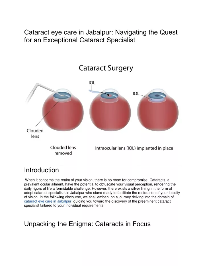 cataract eye care in jabalpur navigating