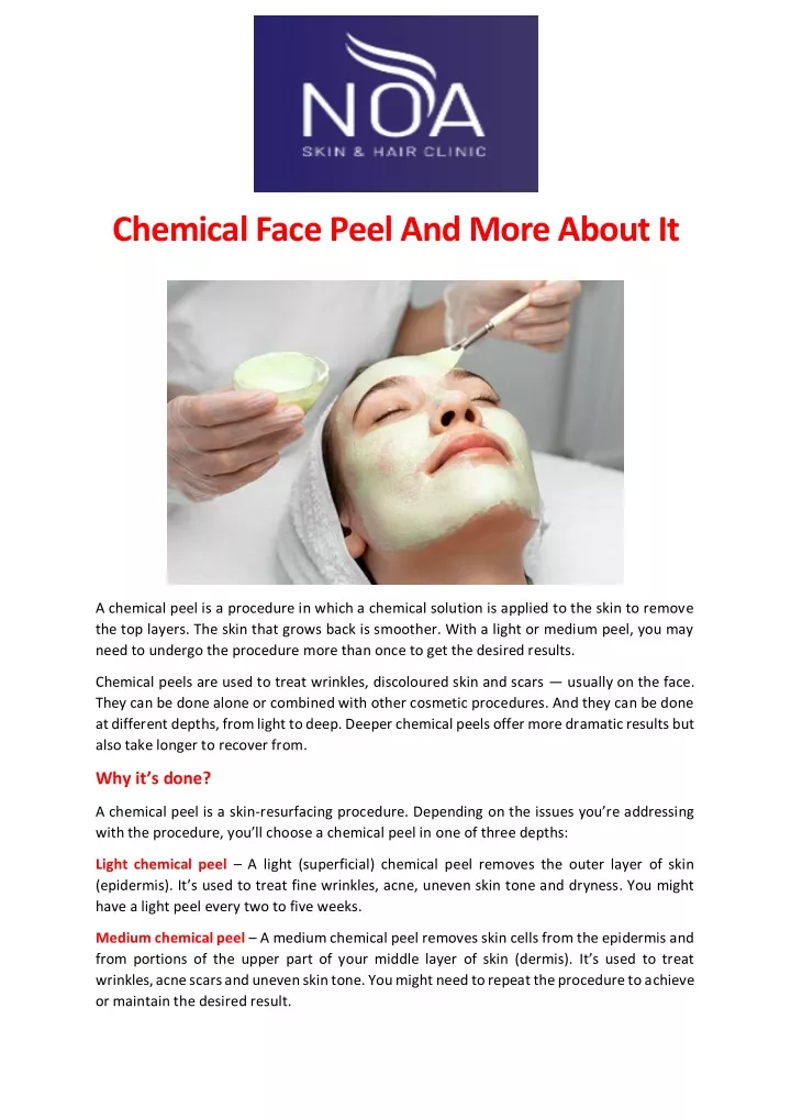 chemical face peel and more about it