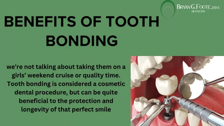 benefits of tooth bonding