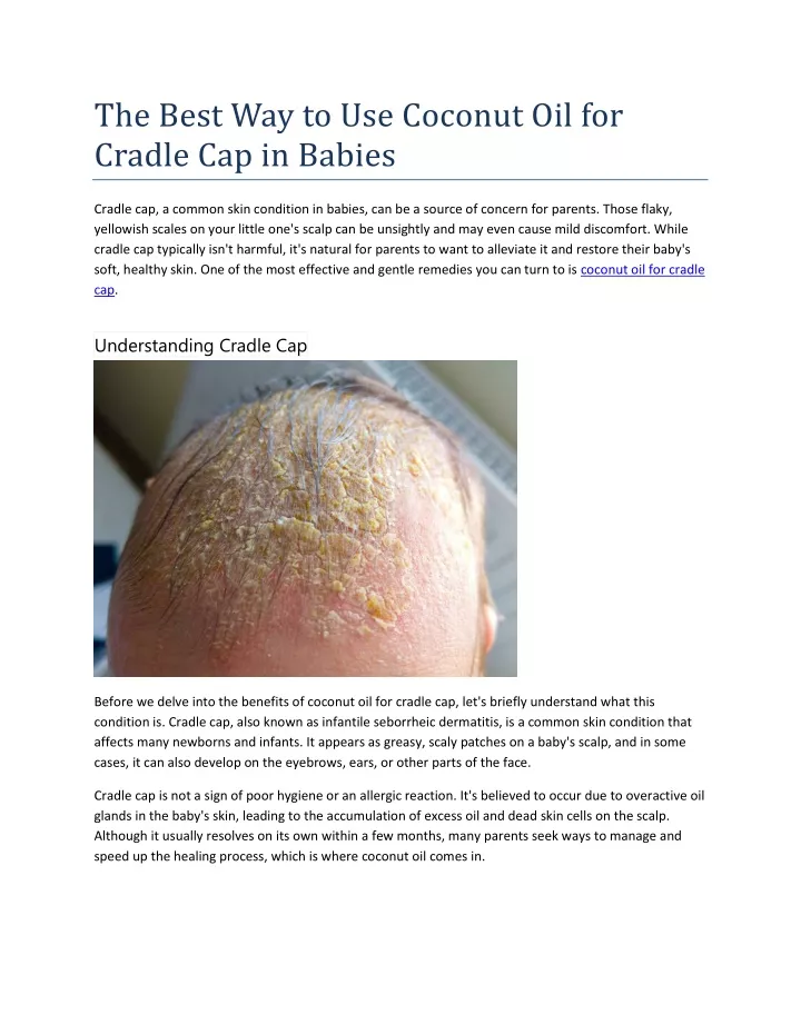 the best way to use coconut oil for cradle