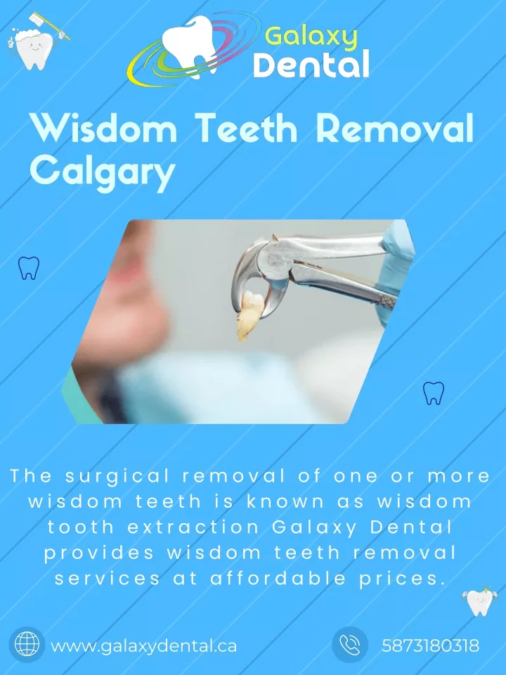 wisdom teeth removal calgary