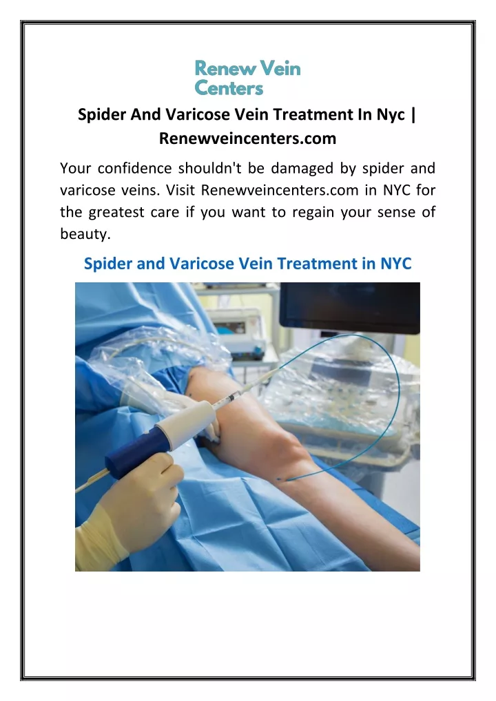 spider and varicose vein treatment