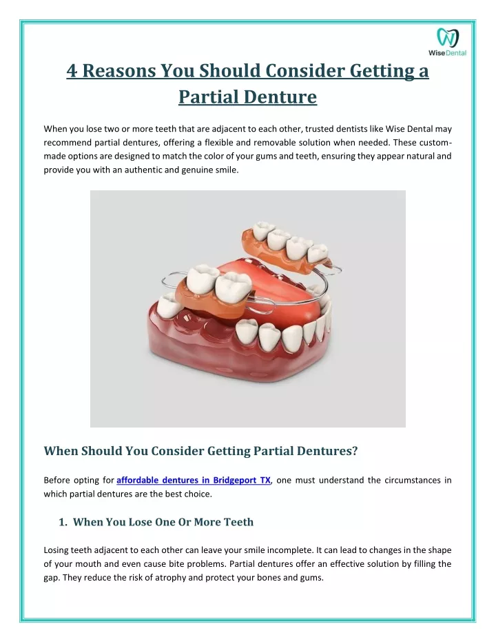 4 reasons you should consider getting a partial