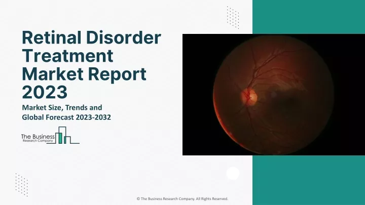 retinal disorder treatment market report 2023