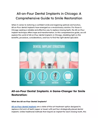 All-on-Four Dental Implants in Chicago_ A Comprehensive Guide to Smile Restoration