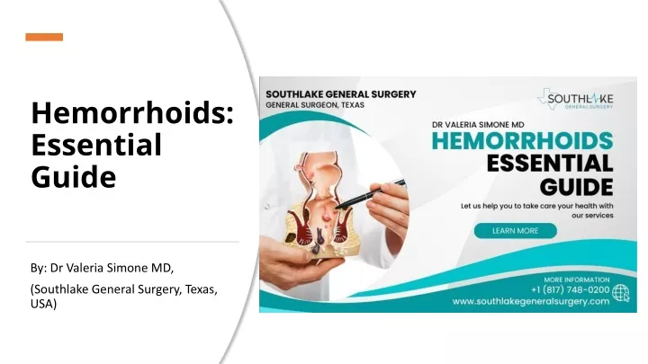hemorrhoids essential guide